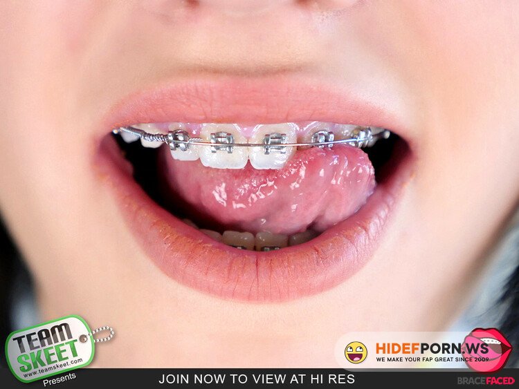 BraceFaced.com/TeamSkeet.com - Karly Baker - The Original Brace Face [HD 720p]