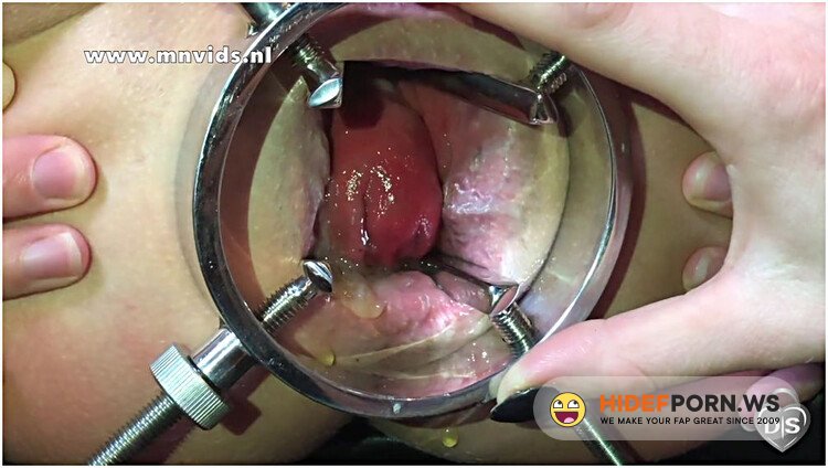 OnlyFans Best extreme anal compilation on the internet [FullHD 1080p]